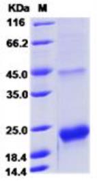 SDS-PAGE (TTR-3880H).jpg